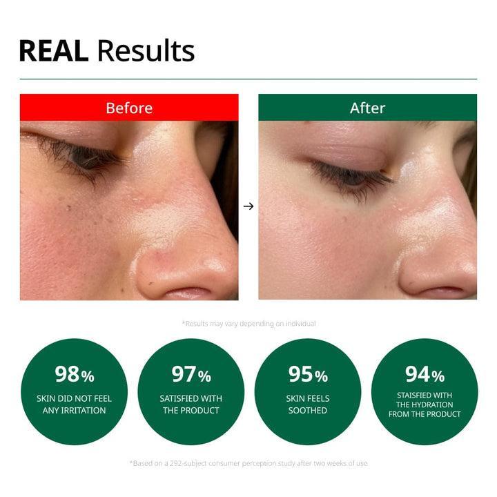 [Dr.G] Red Blemish Clear Soothing Cream 70ml